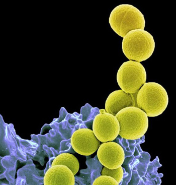 MRSA Bacteria Cells