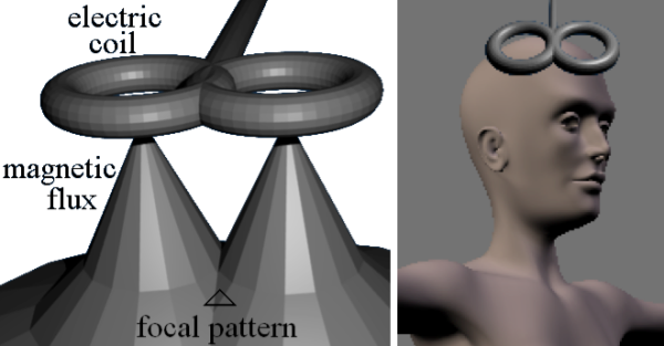 Transcranial Magnetic Stimulation (TMS) Equipment