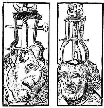 Trepanation (drilling holes in the skull) has been used since prehistoric times in attempts to cure epilepsy, schizophrenia, and other psychological disorders.