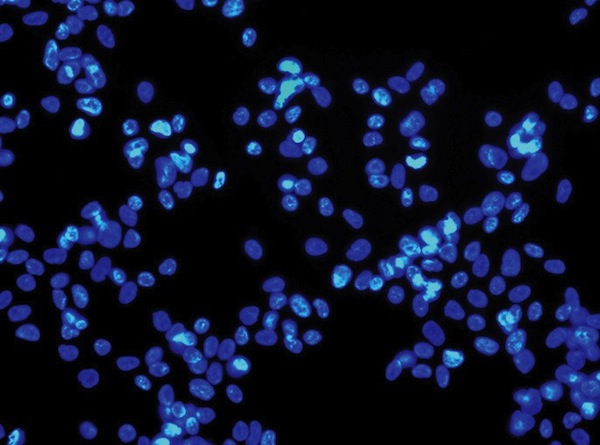 Researchers use dyes, such as these in a sample of stem cells, to determine the action of genes from DNA samples.