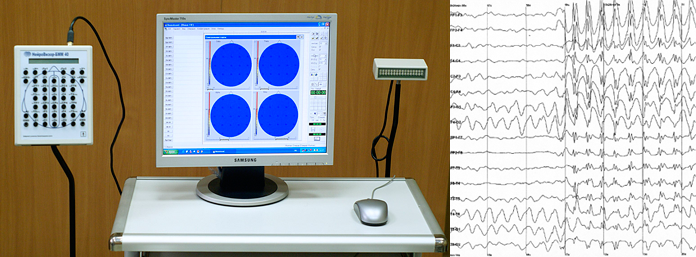 EEG Instrument that Records Electrical Currents from a Brain