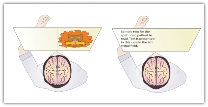 In the sample on the left, the split-brain patient could not choose which image had been presented because the left hemisphere cannot process visual information. In the sample on the right the patient could not read the passage because the right brain hemisphere cannot process language.