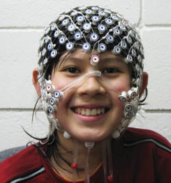A participant in an EEG study has a number of electrodes placed around the head, which allows the researcher to study the activity of the person’s brain. The patterns of electrical activity vary depending on the participant’s current state (e.g., whether he or she is sleeping or awake) and on the tasks the person is engaging in.